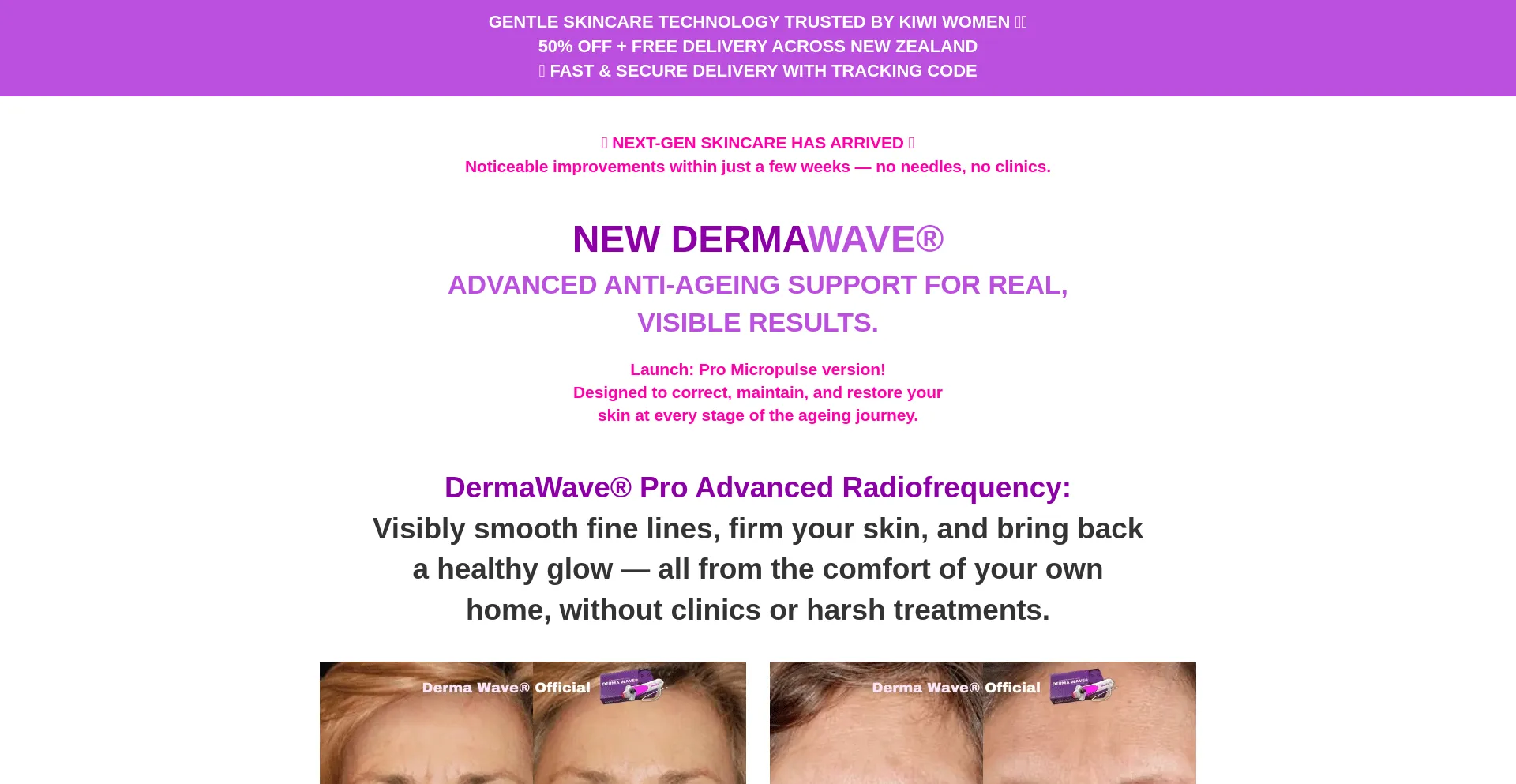 Website screenshot of Dermawave.co.nz